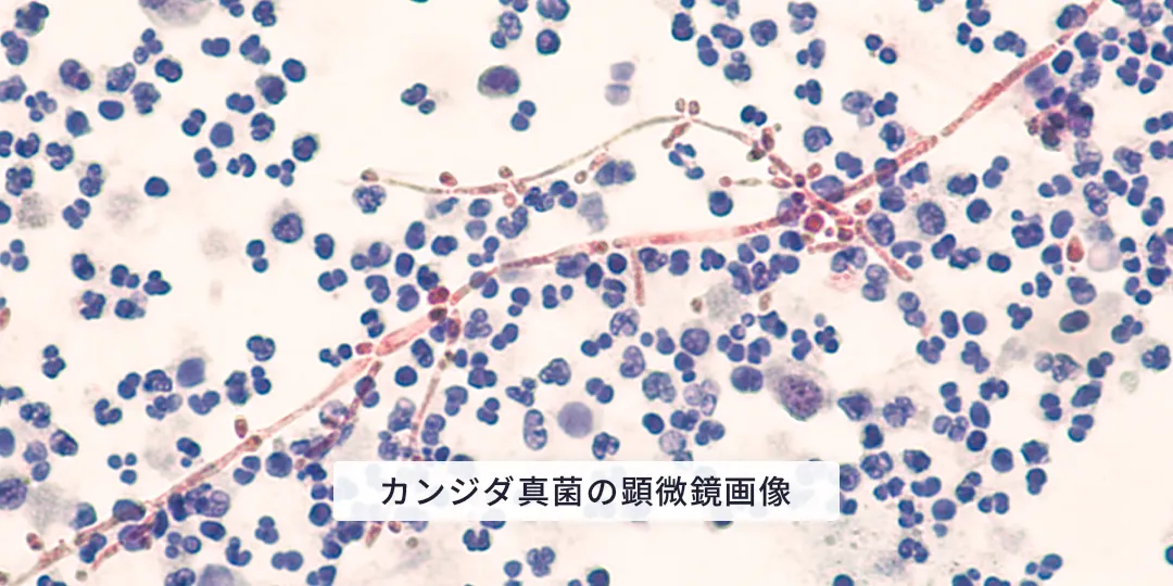 カンジダ菌のイメージ写真