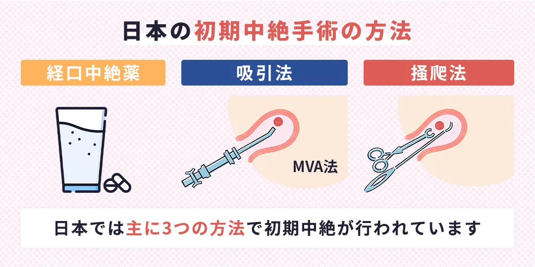日本の初期中絶手術の方法