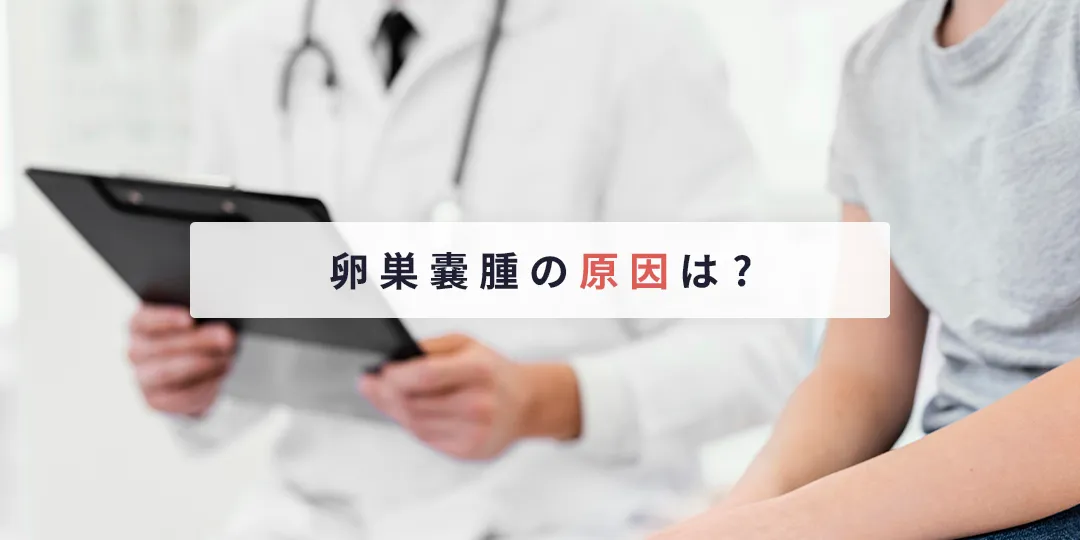 卵巣嚢腫の原因は