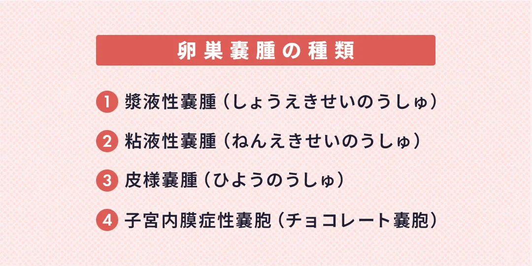 卵巣嚢腫の種類