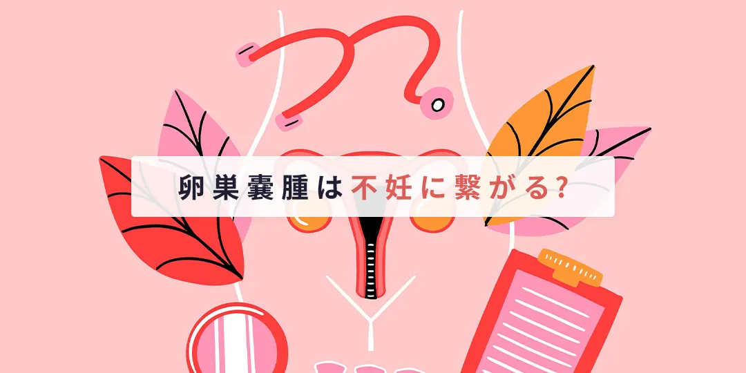 卵巣嚢腫は不妊に繋がる？