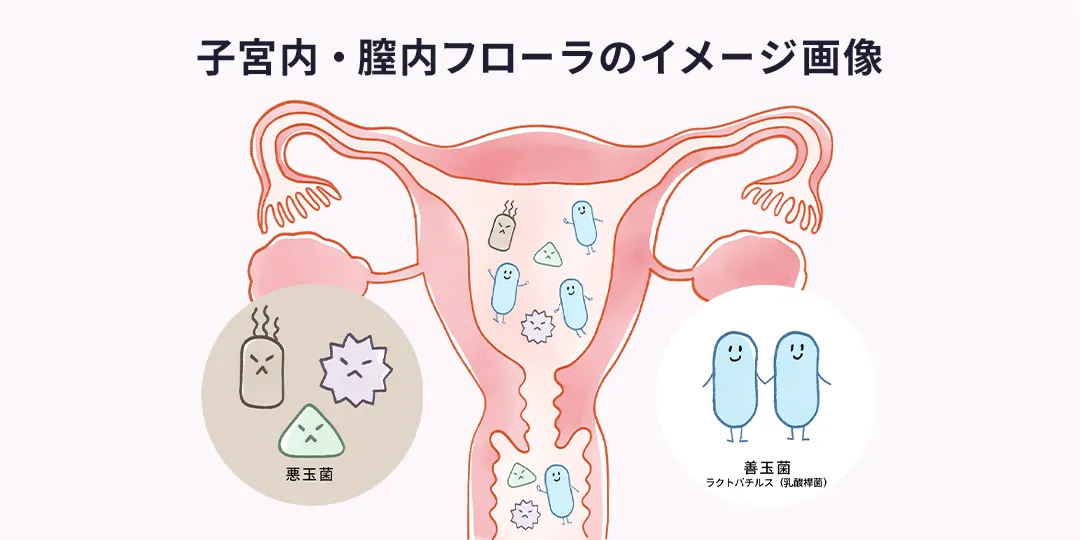 子宮内・膣内フローラのイメージ画像