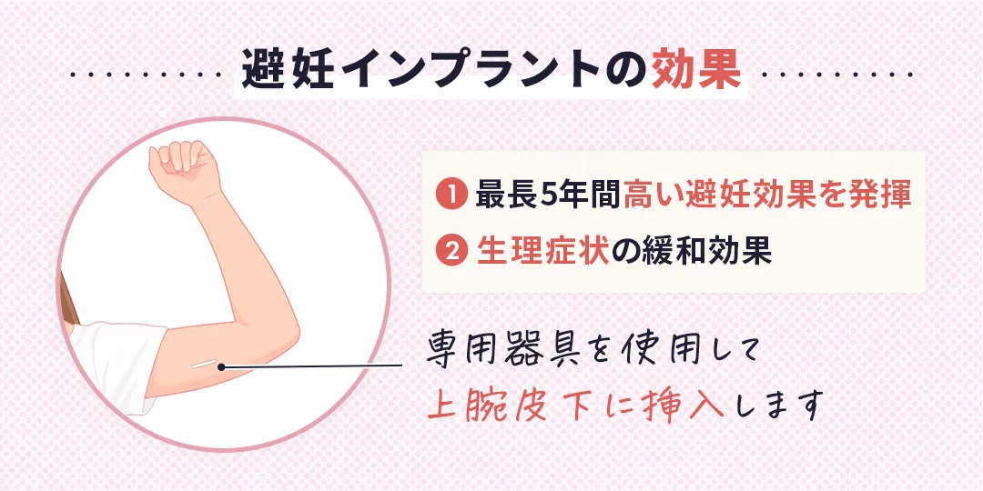 避妊インプラントの効果