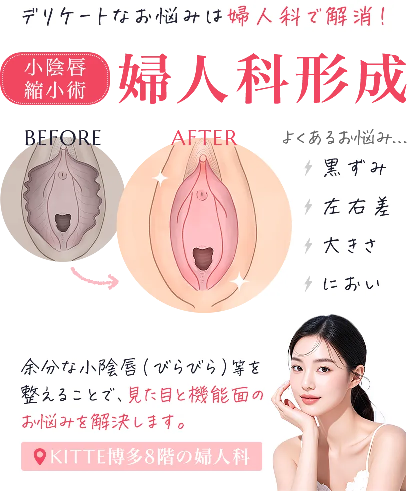 産婦人科専門医による婦人科形成術