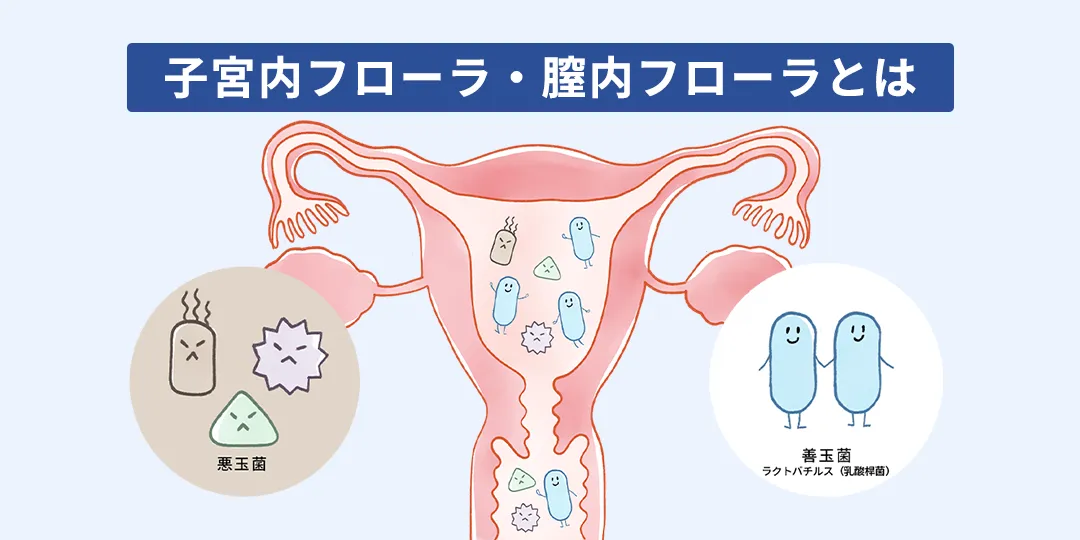 子宮内フローラ・膣内フローラとは?