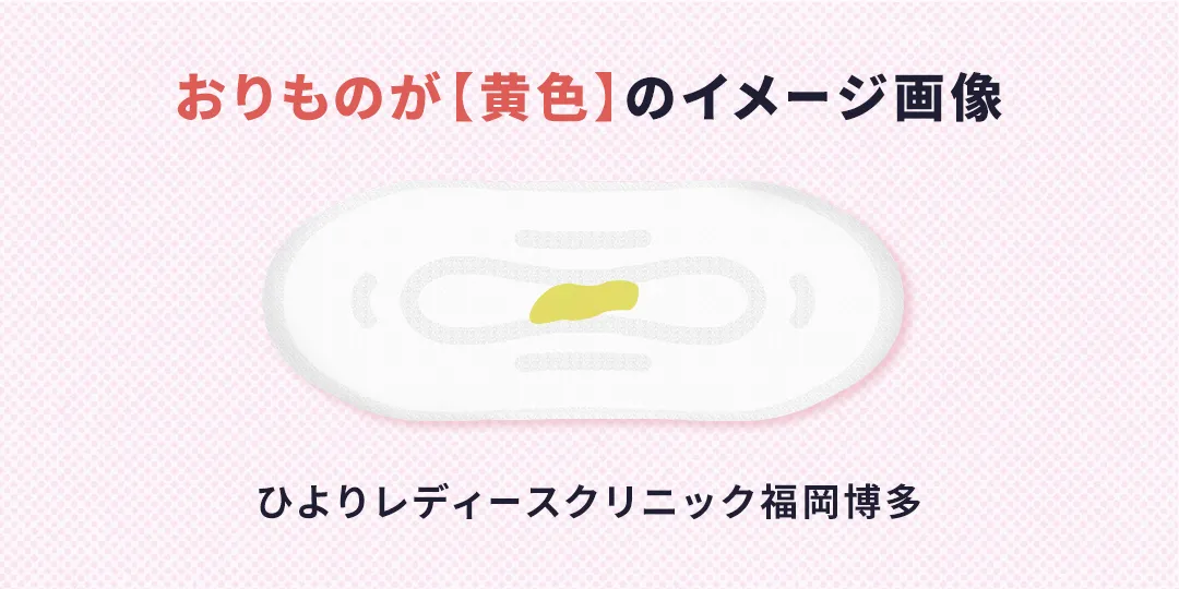 おりものが黄色のイメージ画像